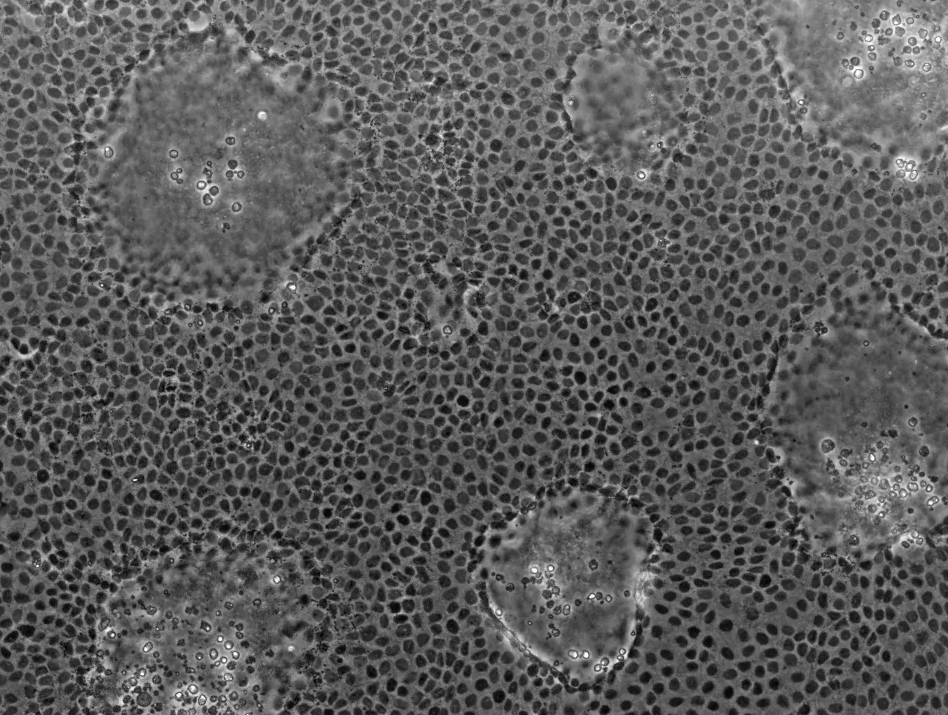 CaCo-2_cells_after_21_days_in_culture-by-Aplarey-on-Wikipedia