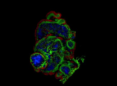 CYTENA - Organoids - 76kb