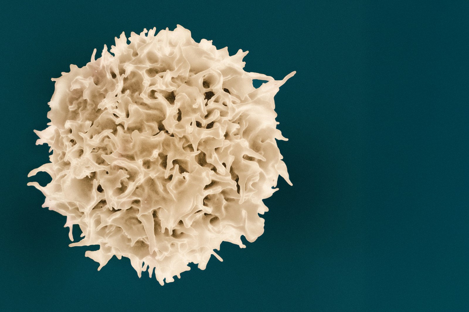 T-Cell-from-NIAIDisease