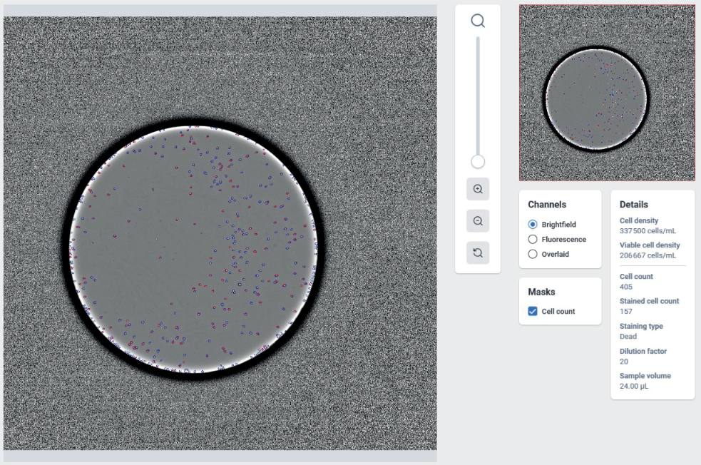 CYT | Tech_Note_24.04_-_AI-powered_Cell_Count_and_VCD_on_the_UP.SI__img-001