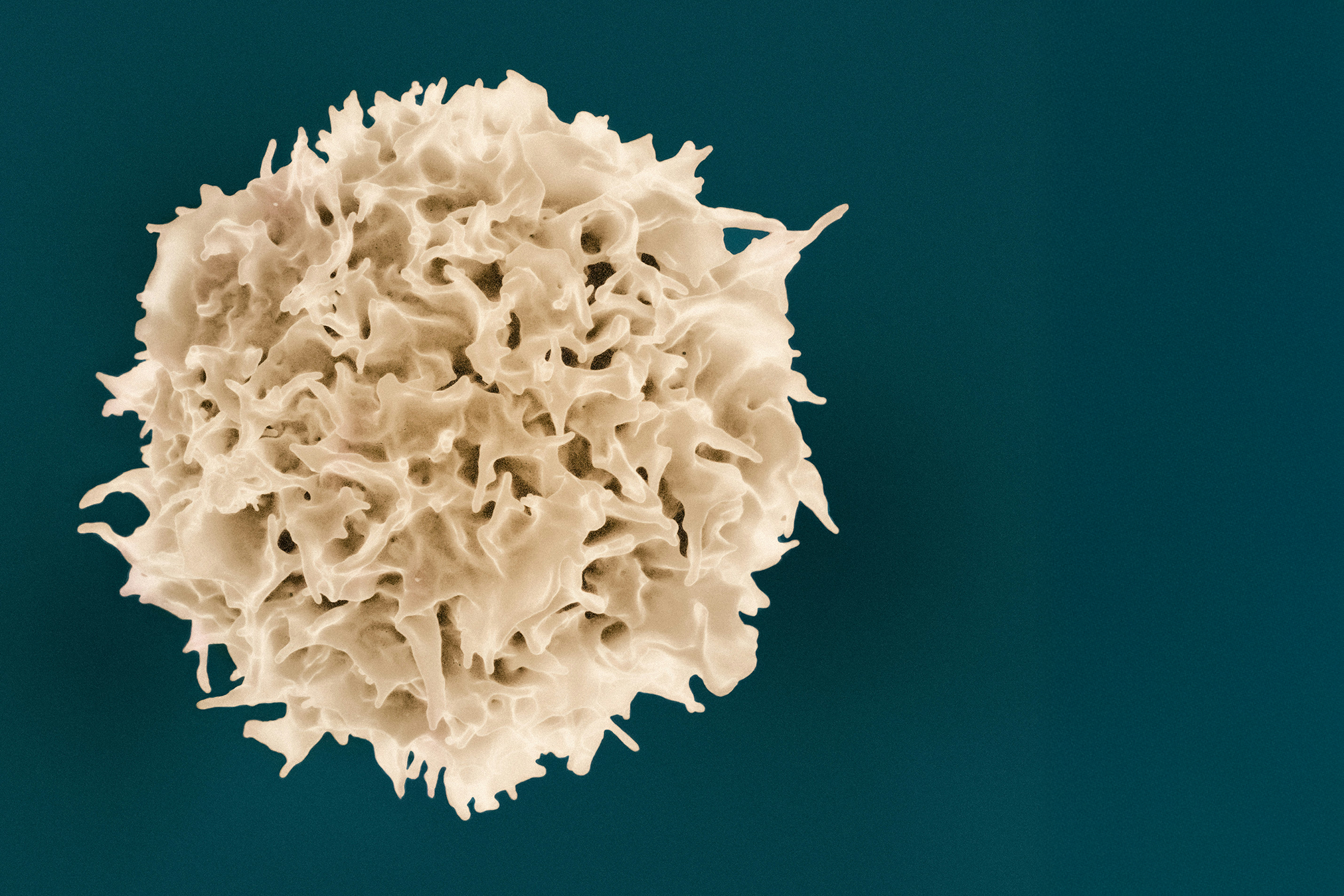 T-Cell-from-NIAIDisease